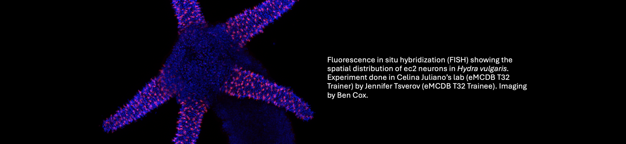 micrscopy image of Hydra vulgaris